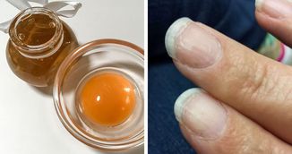 Tratament cu galbenus de ou pentru unghii deteriorate. Cum se prepara