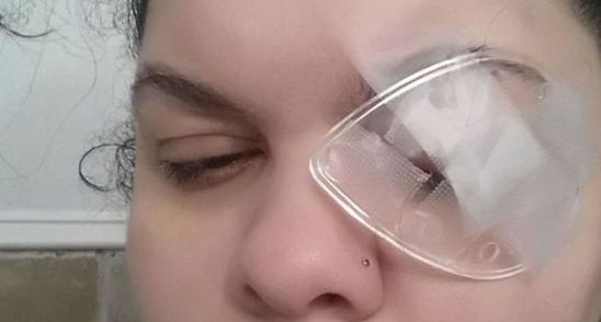 Drama unei femei! A ramas fara un ochi din cauza produselor de make-up. Folosesti asta zilnic