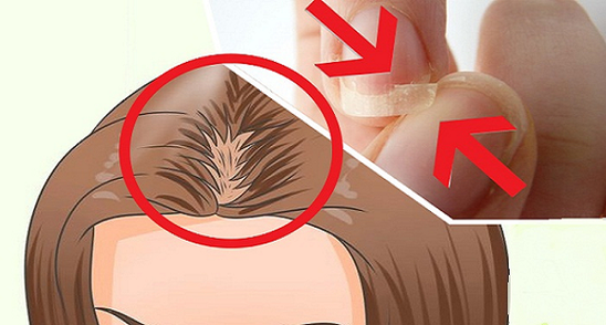 Nu poti sa dormi, ti se rup unghiile si iti cade parul? Uite ce deficienta uriasa ai in organism!