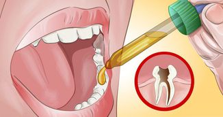 Asta e cea mai usoara metoda prin care scapi de durerile de dinti! Stomatologii sunt uimiti!