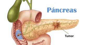 Acestea sunt simptomele de cancer de pancreas pe care nu trebuie sa le mai ignori niciodata