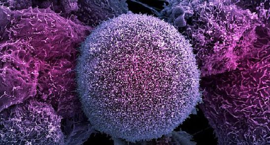 Cancerul moare atunci cand mananci aceste alimente miraculoase