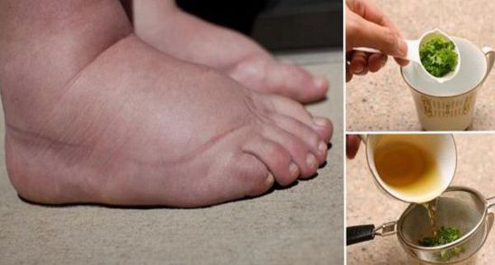 Picioare umflate si circulatie proasta? Consuma acest amestec in fiecare zi!