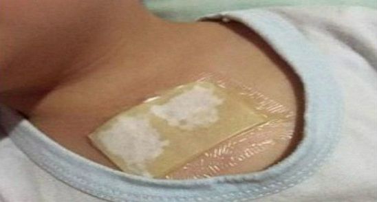 A lipit copilului ghimbir pe piept si a dormit cu el asa! Ce i s-a intamplat cand s-a trezit