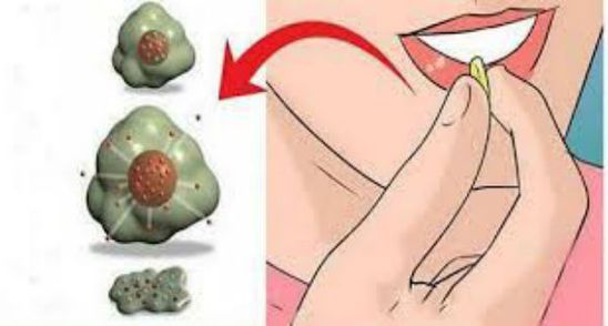 Cancerul moare daca mananci aceste cinci alimente! Include-le urgent in dieta!