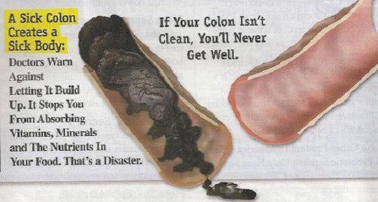 Genial! Cum sa scapi de 10 kilograme de toxine din colon!