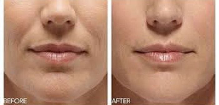 Cum să eliminați grăsimea de buze inferioară Eliminați grăsimea din jurul gurii