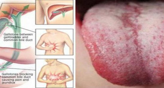 Ai aceste 9 simptome? Detoxifiaza-ti de urgenta organismul! E plin de toxine! 