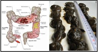 Scoate mizeria si toxinele din colon cu sucul asta puternic! Face minuni!