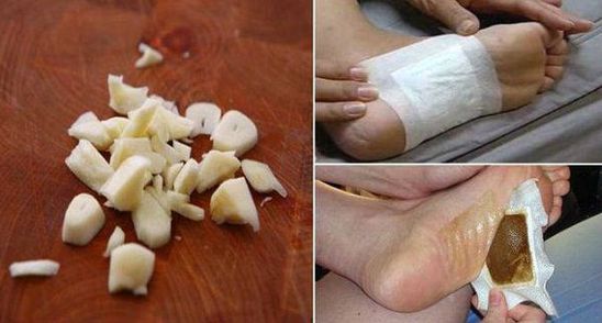 A tocat ceapa si usturoi si le-a pus pe talpa inainte de somn! Ce i s-a intamplat de dimineata! 