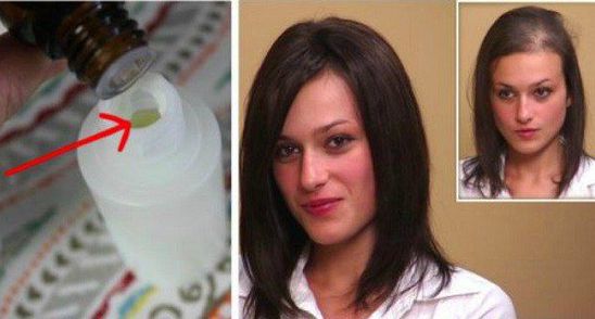 A adaugat asta in sampon si a uitat de caderea parului pentru totdeauna! Incearca trucul ei!