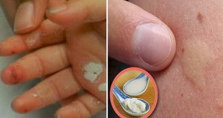   Adevarul despre uleiul de cocos. Ti s-a spus despre el ca este sanatos, iata ce nu stiai