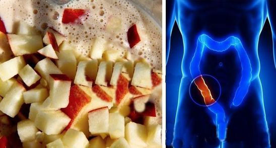 Goleste-ti colonul de toxine cu acest amestec din 4 ingrediente!