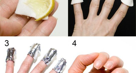 Genial! Si-a invelit unghiile in folie de aluminiu! Ce i s-a intamplat 10 minute mai tarziu! 