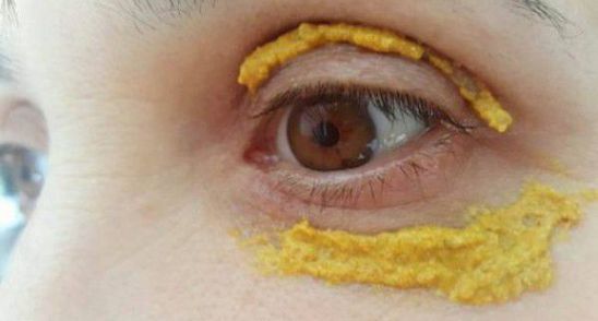 Femeia asta si-a aplicat turmeric in jurul ochilor. N-ai sa crezi ce s-a intamplat dupa 5 zile