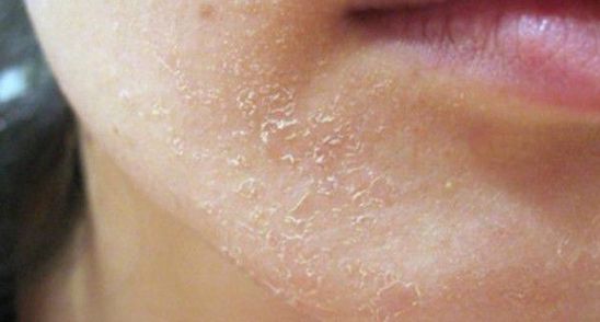 10 semnale vitale pe care ti le trimite corpul cand are nevoie de ajutor!