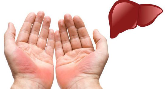 Ai palmele rosii? Poti avea o problema grava de sanatate